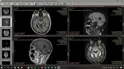 RadiAnt DICOM Viewer.